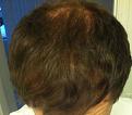 Click image for larger version

Name:	bald4.jpg
Views:	569
Size:	101.2 KB
ID:	466983