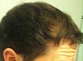 Click image for larger version

Name:	bald5.jpg
Views:	548
Size:	95.9 KB
ID:	466984