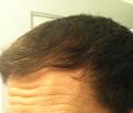 Click image for larger version

Name:	bald6.jpg
Views:	518
Size:	72.5 KB
ID:	466985
