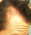 Click image for larger version

Name:	bald1.jpg
Views:	597
Size:	81.4 KB
ID:	466986