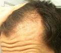 Click image for larger version

Name:	bald2.jpg
Views:	553
Size:	88.2 KB
ID:	466987