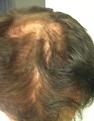 Click image for larger version

Name:	bald3.jpg
Views:	523
Size:	99.1 KB
ID:	466988