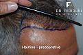 Click image for larger version

Name:	6.jpg
Views:	419
Size:	90.1 KB
ID:	467386