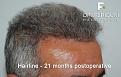Click image for larger version

Name:	7.jpg
Views:	428
Size:	95.6 KB
ID:	467387