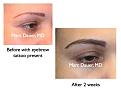 Click image for larger version

Name:	Hair Transplant Slides5.192.jpg
Views:	596
Size:	57.2 KB
ID:	467425