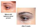 Click image for larger version

Name:	Hair Transplant Slides5.193.jpg
Views:	711
Size:	57.3 KB
ID:	467426