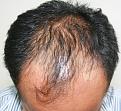 Click image for larger version

Name:	jh before chin down.jpg
Views:	315
Size:	93.2 KB
ID:	467695