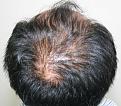 Click image for larger version

Name:	jh before crown.jpg
Views:	296
Size:	91.5 KB
ID:	467697
