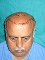 Click image for larger version

Name:	IMG Pre Op.jpg
Views:	563
Size:	72.1 KB
ID:	467758