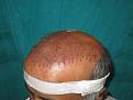 Click image for larger version

Name:	IMG_Intra op 2.jpg
Views:	506
Size:	58.6 KB
ID:	467762