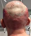 Click image for larger version

Name:	Operation 2.jpg
Views:	631
Size:	31.6 KB
ID:	468028