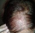 Click image for larger version

Name:	angies hair loss.jpg
Views:	1080
Size:	74.9 KB
ID:	468098