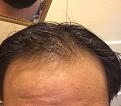 Click image for larger version

Name:	IMG_1175.jpg
Views:	402
Size:	68.6 KB
ID:	468152