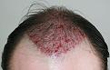 Click image for larger version

Name:	dk - immediate post-op chin down.jpg
Views:	344
Size:	92.5 KB
ID:	469285