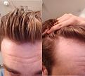 Click image for larger version

Name:	Hair 2.jpg
Views:	309
Size:	65.8 KB
ID:	469326