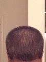 Click image for larger version

Name:	hair4.jpg
Views:	532
Size:	40.8 KB
ID:	469428