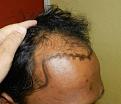 Click image for larger version

Name:	Pre_op_2.jpg
Views:	360
Size:	26.5 KB
ID:	469467