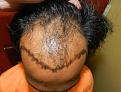 Click image for larger version

Name:	Pre_op_5.jpg
Views:	326
Size:	36.7 KB
ID:	469470