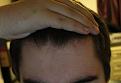 Click image for larger version

Name:	Hairline 241014.jpg
Views:	499
Size:	92.7 KB
ID:	469541