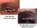 Click image for larger version

Name:	Hair Transplant Slides8.340.jpg
Views:	543
Size:	68.7 KB
ID:	469802