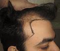 Click image for larger version

Name:	Pre_op_1.jpg
Views:	2182
Size:	92.2 KB
ID:	469882