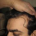 Click image for larger version

Name:	Pre_op_2.jpg
Views:	1234
Size:	89.1 KB
ID:	469883