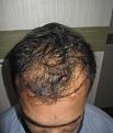 Click image for larger version

Name:	Pre_op_1.jpg
Views:	415
Size:	92.6 KB
ID:	469914
