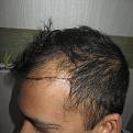 Click image for larger version

Name:	Pre_op_2.jpg
Views:	396
Size:	88.4 KB
ID:	469915