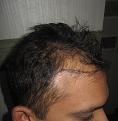 Click image for larger version

Name:	Pre_op_3.jpg
Views:	397
Size:	86.5 KB
ID:	469916
