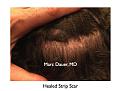 Click image for larger version

Name:	Hair Transplant Slides.366.jpg
Views:	235
Size:	75.4 KB
ID:	469971