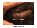 Click image for larger version

Name:	Hair Transplant Slides.366.jpg
Views:	317
Size:	75.4 KB
ID:	469971