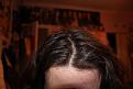 Click image for larger version

Name:	Hair Scalp 2.jpg
Views:	1144
Size:	88.7 KB
ID:	469984