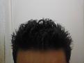 Click image for larger version

Name:	forehead.jpg
Views:	606
Size:	87.8 KB
ID:	470093