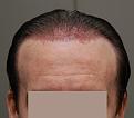 Click image for larger version

Name:	7.jpg
Views:	400
Size:	81.1 KB
ID:	470102
