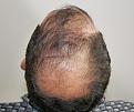 Click image for larger version

Name:	cs before chin up.jpg
Views:	302
Size:	95.5 KB
ID:	470144