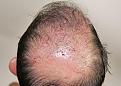 Click image for larger version

Name:	cs immediate post-op chin up.jpg
Views:	289
Size:	94.5 KB
ID:	470148
