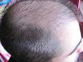 Click image for larger version

Name:	IMG_2001.jpg
Views:	369
Size:	89.1 KB
ID:	470264