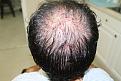 Click image for larger version

Name:	IMG_41001.jpg
Views:	515
Size:	94.9 KB
ID:	470307