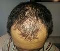 Click image for larger version

Name:	Pre-op top.jpg
Views:	516
Size:	34.0 KB
ID:	470315