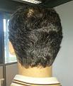 Click image for larger version

Name:	pre-op back side.jpg
Views:	404
Size:	35.6 KB
ID:	470318