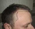 Click image for larger version

Name:	IMG_3222.jpg
Views:	883
Size:	90.9 KB
ID:	470339