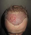 Click image for larger version

Name:	Post_op_1.jpg
Views:	587
Size:	89.9 KB
ID:	470386