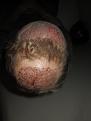 Click image for larger version

Name:	Post_op_5.jpg
Views:	554
Size:	91.6 KB
ID:	470390