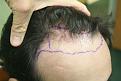 Click image for larger version

Name:	preop4.jpg
Views:	669
Size:	71.3 KB
ID:	470516