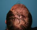Click image for larger version

Name:	dc immediate post-op chin up.jpg
Views:	313
Size:	91.7 KB
ID:	470594