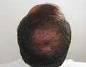 Click image for larger version

Name:	dc 4 year post-op chin up.jpg
Views:	332
Size:	93.0 KB
ID:	470597