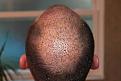 Click image for larger version

Name:	Day 5 back.jpg
Views:	529
Size:	86.5 KB
ID:	470710