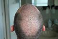 Click image for larger version

Name:	Day 4 back.jpg
Views:	521
Size:	89.6 KB
ID:	470712