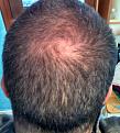 Click image for larger version

Name:	headscared.jpg
Views:	427
Size:	89.0 KB
ID:	470742