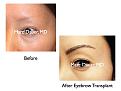 Click image for larger version

Name:	Hair Transplant Slides.505.jpg
Views:	904
Size:	54.8 KB
ID:	470753
